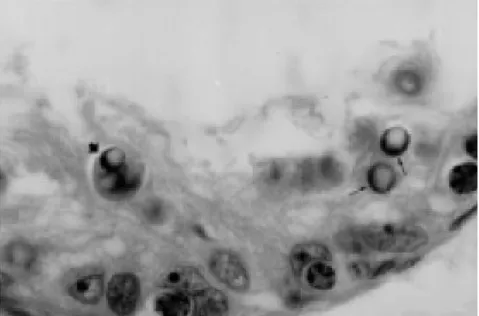 Şekil  2.3.  Rat  testisinde  apoptotik  hücrelerin  yarım  ay  şeklindeki  çekirdekleri,  koyu eozinofilik sitoplazmalı apoptotik hücreler (Öztürk, 2002)
