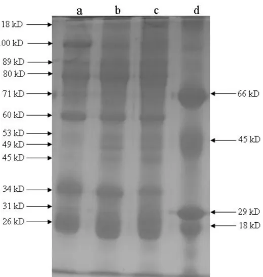 Figure  1:  Electrophoregram  obtained  from  the  SDS-PAGE  of  the  serum  proteins  of  the  fish  exposed to nitrogen fertilizer 