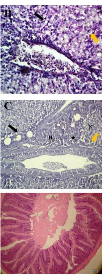 Figure  2B.  Liver  tissue  exposed  to  15  mg/L  nitrogen  fertilizer.  Necrosis  (N),  Pyknotic  degeneration  (black  arrow),  vacuolar  degeneration  (orange  arrow)  and  Mononuclear  cell  infiltration  (MHI)  (star)