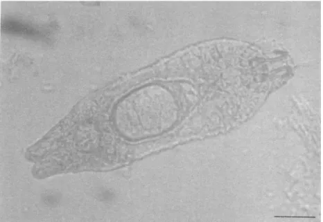 Figure 1. An individual of Gyrodactylus arcuatus Bychowsky, 1933.   Scale bar: 100 µm.