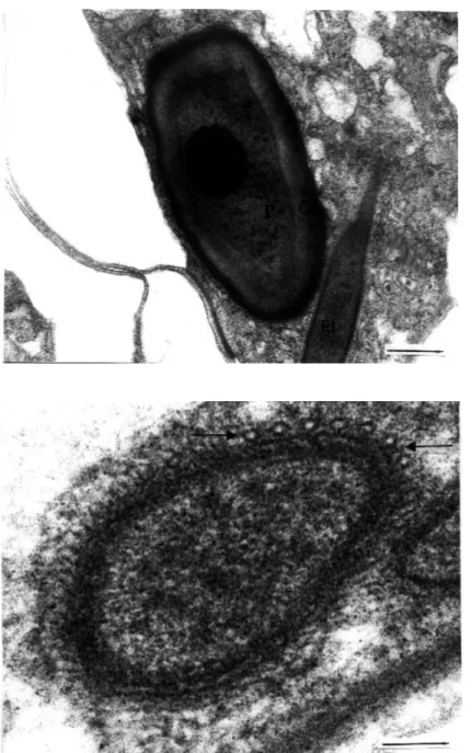 Figure 17.  A transverse section of the external tube showing some microtubule  forma-tion at the distal part (arrows) in raabeia (uranyl acetate / lead citrate, x 130000) (Bar: 0.1 µm).