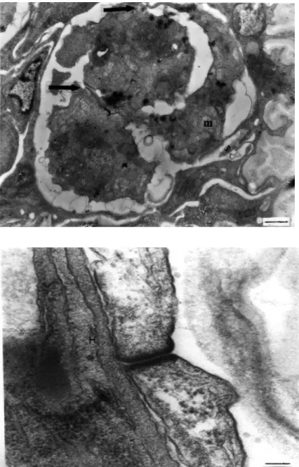 Figure 7.  A  desmosomal junction between two enveloping somatic cells in  echinactinomyx-on