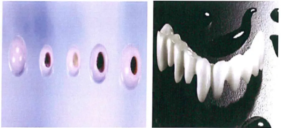Şekil 2. 18  Zirkonya femur başları ve bir zirkonya diş köprüsü örneği (Chevalier, 2006)