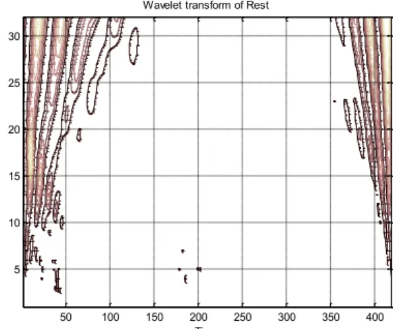 Figure 8.  The wavelet transforms of an EMG signal (scalogram of Rest’s  situation). 