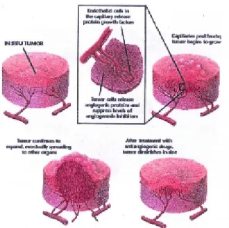 Figure 2: Formation of metastasis of a tumor.