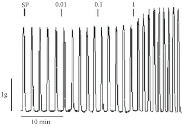 Figure 1. Original trace of a myometrial strip. SP: Spontaneous contractions, 0.01 μM, 0.1 μM, and 1 μM concentrations of ghrelin cumulatively