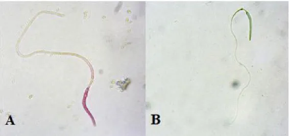 Fig 1:  Stained  dead  (A)  and  non-stained  living  (B)  Microscopic  view  of  sperm