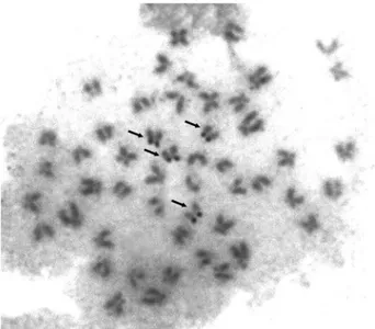 Figure 1. Silver-stained metaphase cell of 