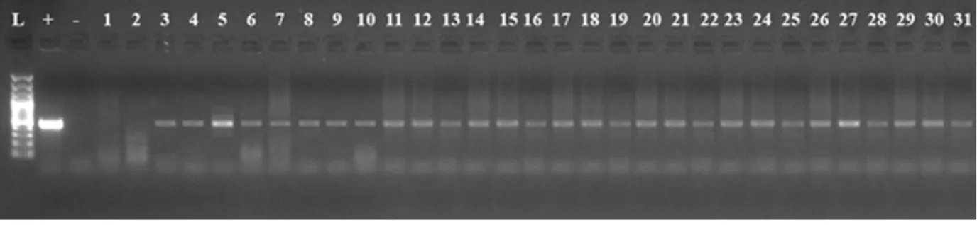 Figure 2.  PCR analysis of genomic DNA from putative transgenic plants cv. ‘Madaras’ developed from hypocotyl explants taken from the position  1 for amplification of 458 bp npt-II