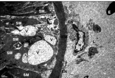 Figure 6:  Group 2. Most of the endothelial cells (EN) showed  separation from the basal lamina of the tunica intima