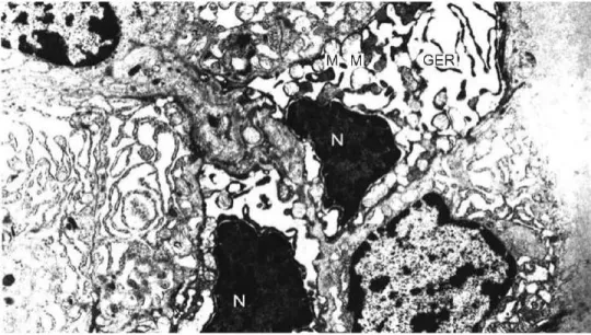 Figure  1.  Electron  micrograph  of  the  thyroid  tissue  of  the  methamidophos-treated  rats  (group  1)  showing  pyknoUc  nuclei  (N),  degenerated  mitochondria  (M),  and  dilated  granular  endoplasmic  reticulum  (GER)  cisternae  (uranyl  acetat
