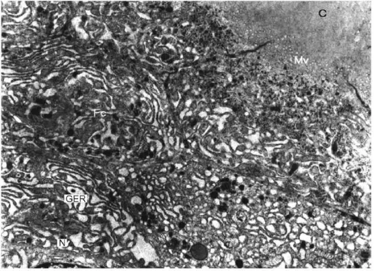 Figure 6.  Electron  microscopic  examination of  the  thyroid tissue  of  the  control  group  for group 3  (group 4)