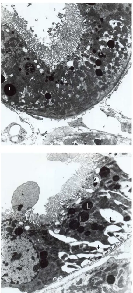 Fig. 6. Group 3, proximal convoluted tubule. Lytic areas (asterix) are seen. Vacuoles (V), lysosomes (L), brush border (BB)