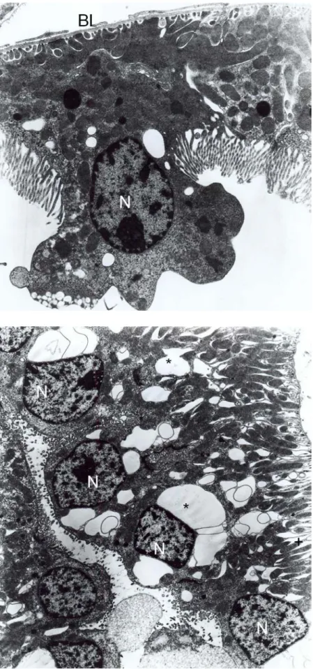 Fig. 9. Group 5, distal convoluted tubule. Increased vacuoles (V) and deep foldings (asterix) are noticed