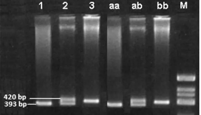 Fig. 1. Polymorphism in intron 16 of the ACE gene. 