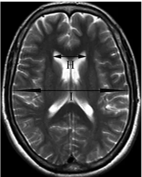 Figure 1 Midsagittal T1-weighted SE MRI (TR/TE, 450/ 11 ms) of measurement sites of a normal adult