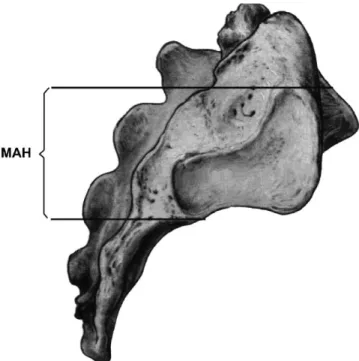 TABLE 1. Morphometric Measurements of the Sacrum