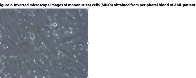 Figure 2. Inverted microscope images of mononuclear cells (MNCs) obtained from peripheral blood of AML patient 