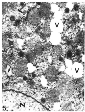 Figure 6. Chronic group. Dilated perinuclear cisterna (arrows) and granular endoplasmic reticulum cisternae (GER) are seen in the cytoplasm of the hepatocyte