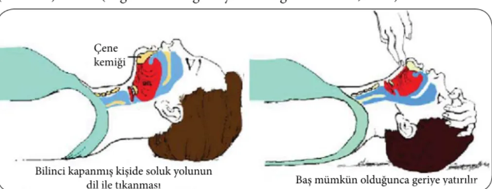 Şekil 6. Baş-çene pozisyonu