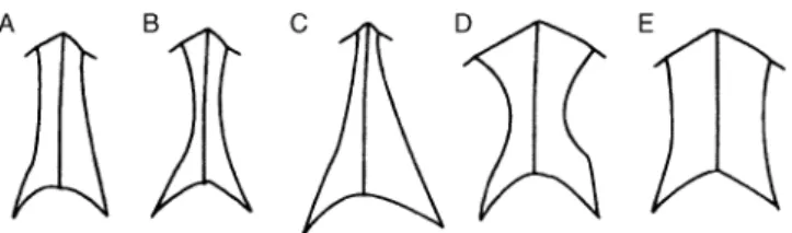 FIGURE 2. Classification of nasal bone type according to Hwang et al. 15