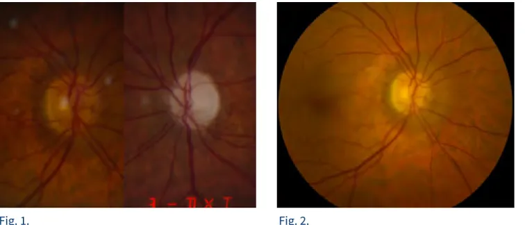 Fig. 1.            Fig. 2.