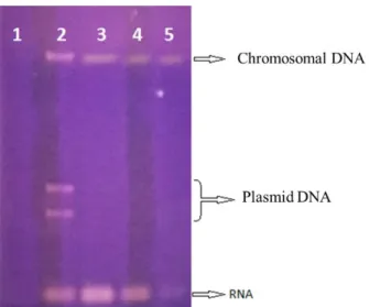 Figure 3: DNA isolation gel image using egg white solution (1: Control with no lysozyme  added, 2: Plasmid DNA isolation using egg white solution, 3: Genomic DNA isolation using  commercial lysozyme, 4-5: Egg white solution (Genomic DNA isolation using 100
