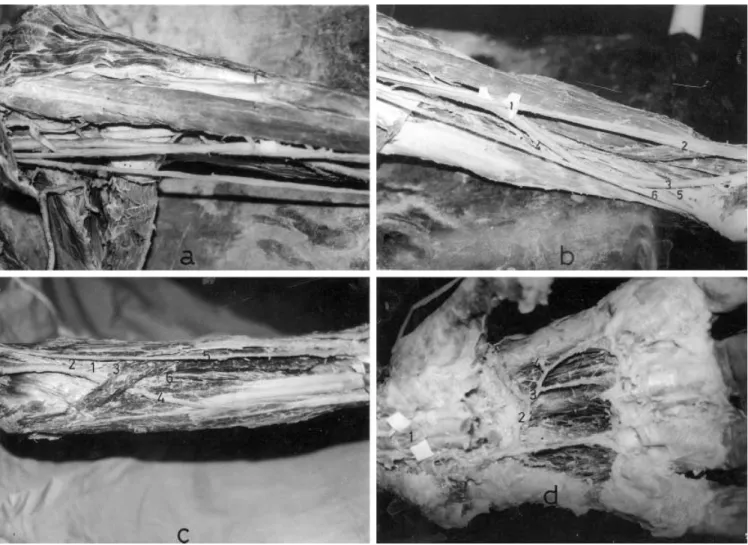 Fig. 2. A Left axillary a. and the muscular branches of the left radial a. to biceps brachii