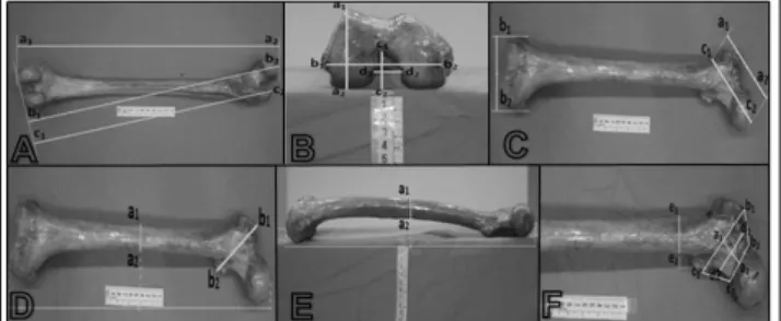 Figure 1. A. Maximum Femur Length (a1-a2), Physiological Femur  Length (b1-b2), Physiological Trochanter Length (c1-c2)