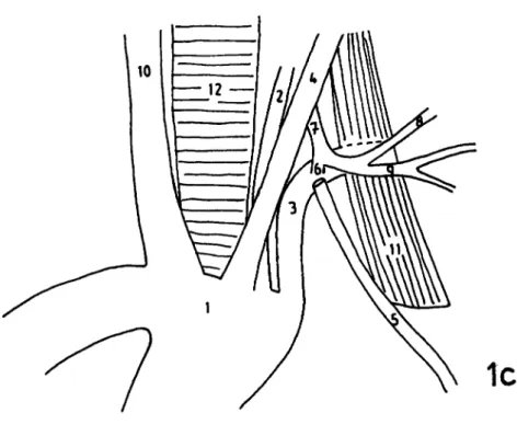 Fig.  1.a.  The branches arising from the left side of  aortic arch. b) The  left vertebral artery originated from aortic  arch