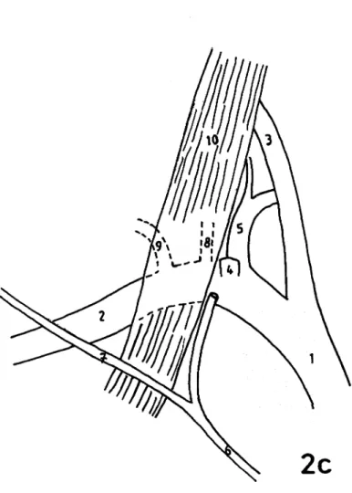 Fig.  2.a.   The  branches  arising  from  the  right  side  of  aortic  arch.  b)  The  scalenus  anterior  muscle  was  dissected  and  retracted  to  demonstrate  the  right  subclavian  artery  and  its  branches