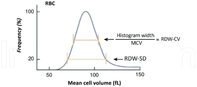 Figure 4.  Red blood cell distribution width. Automated counters provide measurements of the width of the red blood  cell distribution curve