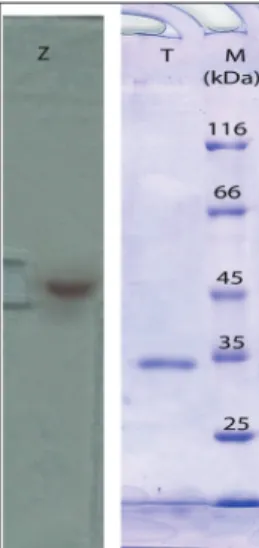 Fig. 5. Electrophoretic analysis of the tyrosinase M36. Lane Z 