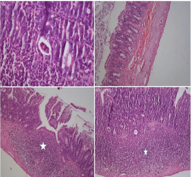 Figure 5. Intestine, radiation-induced histopathological changes. Histopathology is shown under the light microscope of the intestine using haematoxylin –eosin (H&amp;E) in the rats that received RT