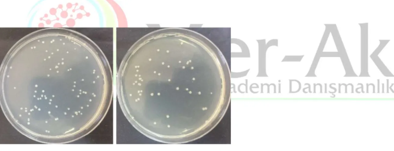 Figure 4. Petri dishes photos for S. aureus and K. pneumonia at 