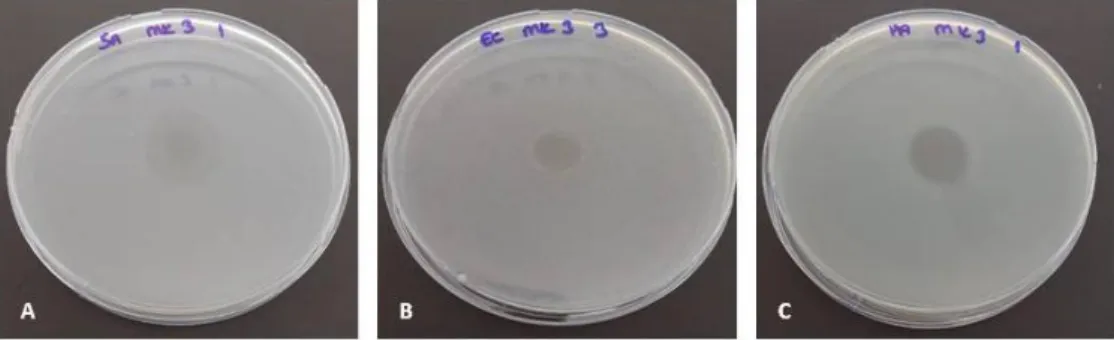 Şekil 4.4 MK3'ün S.aureus (A), E.coli (B) ve P. aeruginas'a (C) etkisi 
