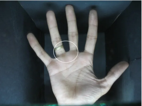 Figure 3.4: Hand palm image showing ring association with finger. 