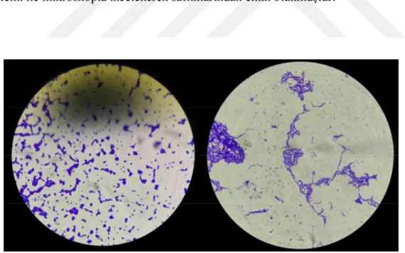 Şekil 3.1: İzolatların mikroskopta incelenmesi 