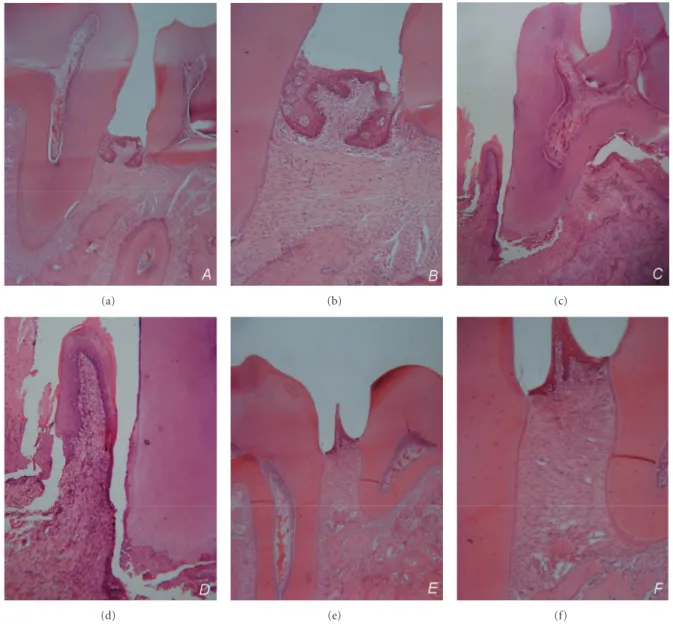 Figure 2: Photomicrographs of the periodontium from the mesial-distal sections of mandibular first molars