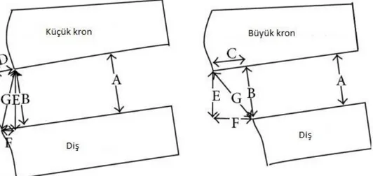 ġekil 2.7:  Marjinal Aralık Tanımı  A = İç Boşluk;  B = Marjinal Boşluk (bu  çalışmada ölçülen); C = Fazla Uzatılmış Kron Kenarı; D = Kısa Kalmış Kron Kenarı; 