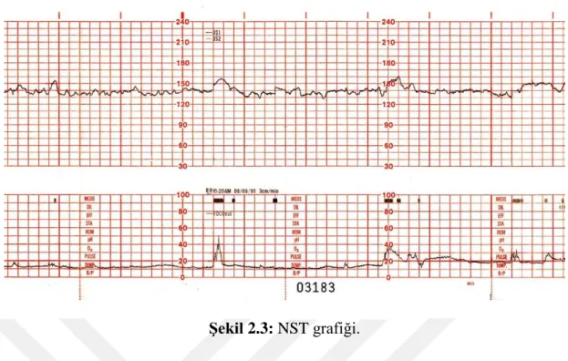 Şekil 2.3: NST grafiği. 