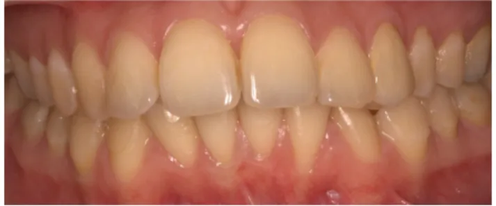 Figure 7: Case-2, after 6 months.