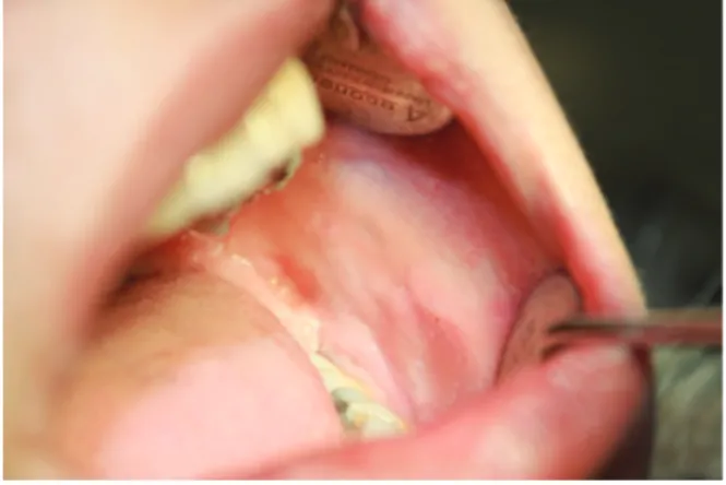 Figure 4. Intraoral image after 24 months