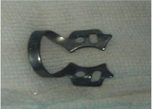 Figure 2. Ingested rubber dam clamp