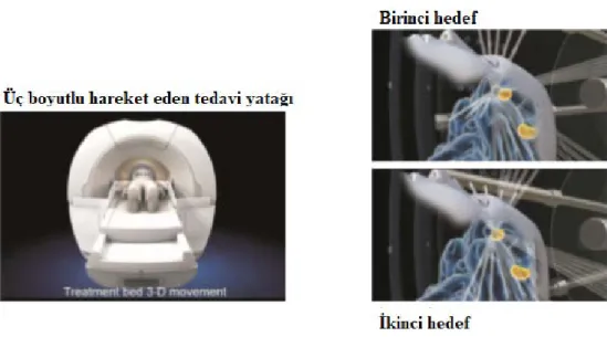 Şekil 2.6: Üç Boyutlu Hareket Eden Tedavi Yatağı Ve Hedefleme (69) 