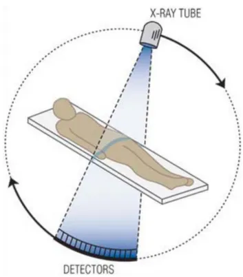 Figure 1.3: person was exposed to some X-ray beam in the form of a fan and the  projected image can also be shot to the semi-circular digital X Ray sensor   Source: Url-1 