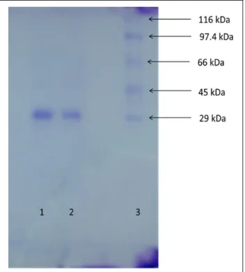 Figure 2. Sodium dodecyl sulfate–polyacrylamide gel elec- elec-trophoresis (SDS-PAGE) analysis of purified CA II