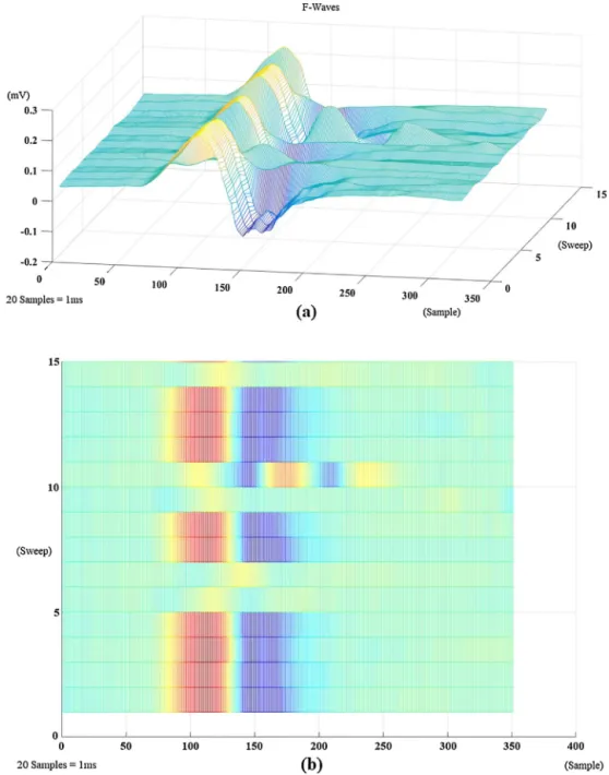 Fig. 2. F-Waves After the Cutting Operation. a) Isometric view. b) Colormap of top view.