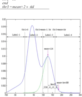Figure 1: Determination of adaptive threshold levels from the  histogram of the spleen and perisplenic region
