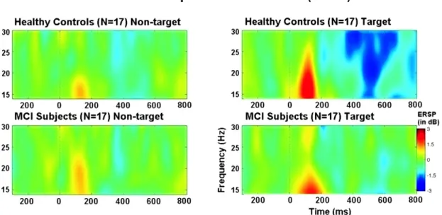 Fig. 4 illustrates the grand averages of beta responses in F 4 electrode